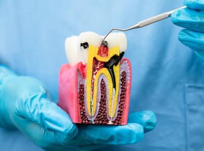 What’s Beneath the Surface: A Las Vegas Dentist Explains Tooth Roots and Oral Health
