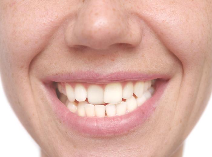 Do I Need to See the Dentist? 7 Signs You Shouldn’t Ignore