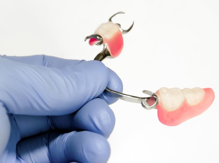 How to Choose Between a Dental Bridge or Partial Dentures