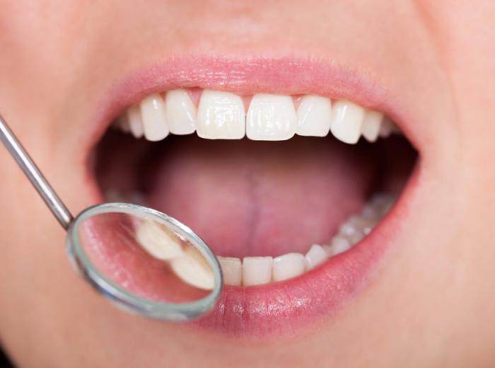 What Really Happens at a Checkup & Cleaning: Dentist in Vegas Breaks It Down