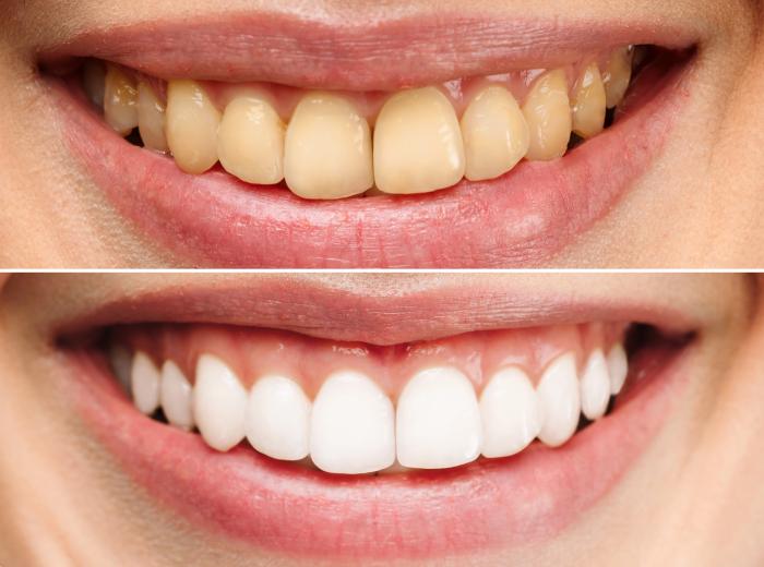 Discolored Teeth? The Surprising Causes You Didn’t See Coming