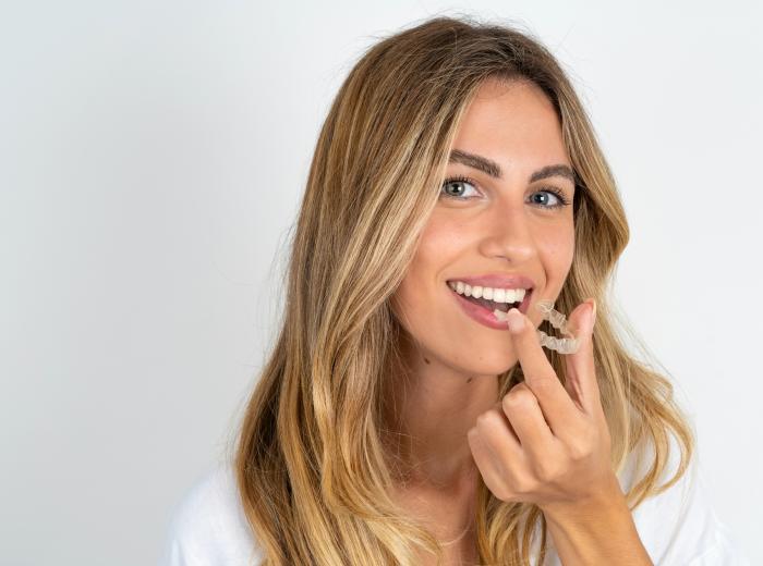 Can Invisalign® give you cavities?
