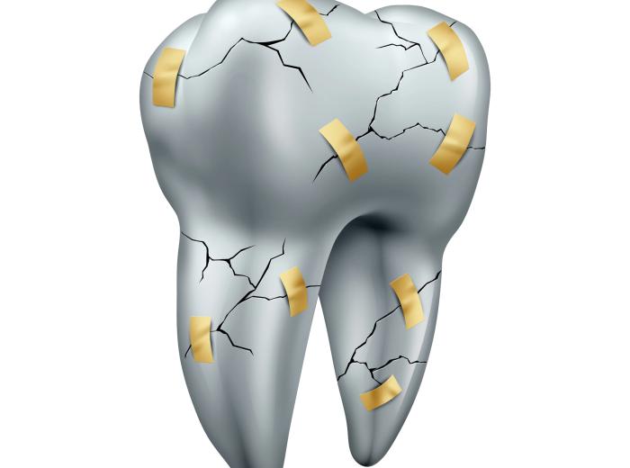 Everyday Habits That Increase Your Risk of a Broken Tooth