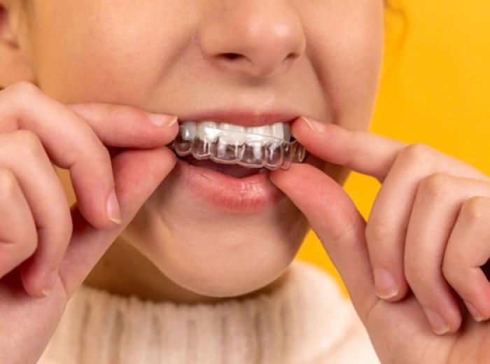 Invisalign Dentist in Las Vegas Answers Questions About Clear Aligners