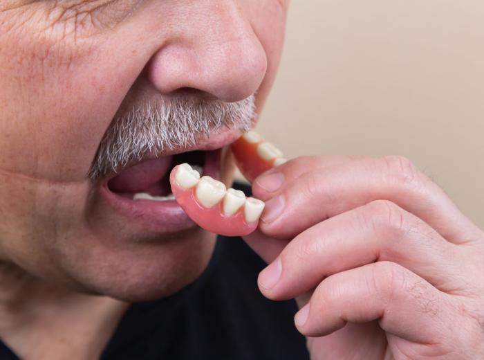 How to Choose Between Partial Dentures vs. Dental Bridges