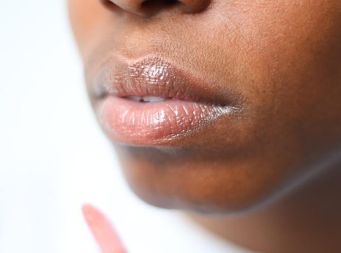 Lips and Sun Damage: Dentist in Vegas Explains the Importance of SPF Protection
