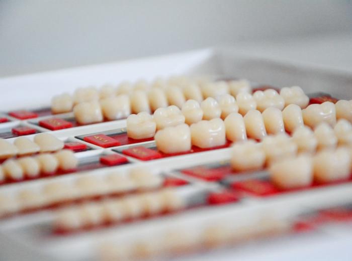 5 Ways to Improve Your Smile with Dental Crowns
