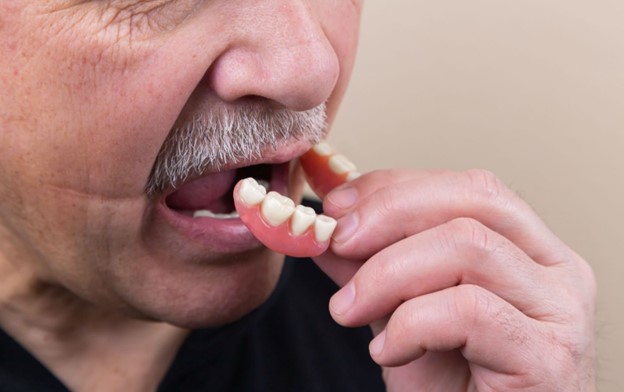 Man with open mouth inserts partial dentures in Las Vegas, NV