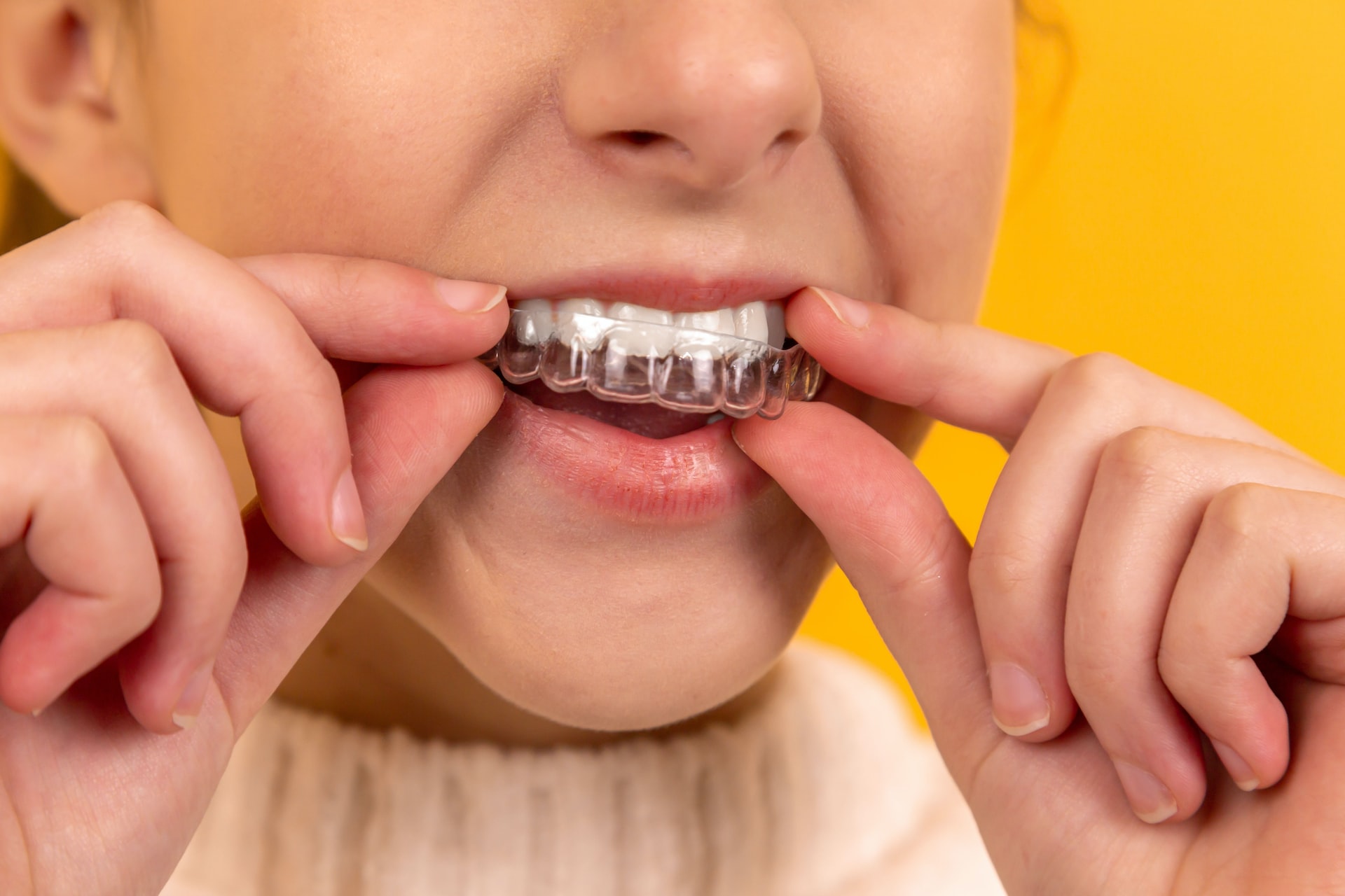 Person places an Invisalign tray in their mouth after visiting a dentist in Las Vegas, NV