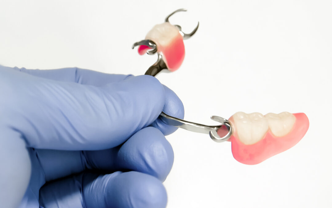 How to Choose Between a Dental Bridge or Partial Dentures