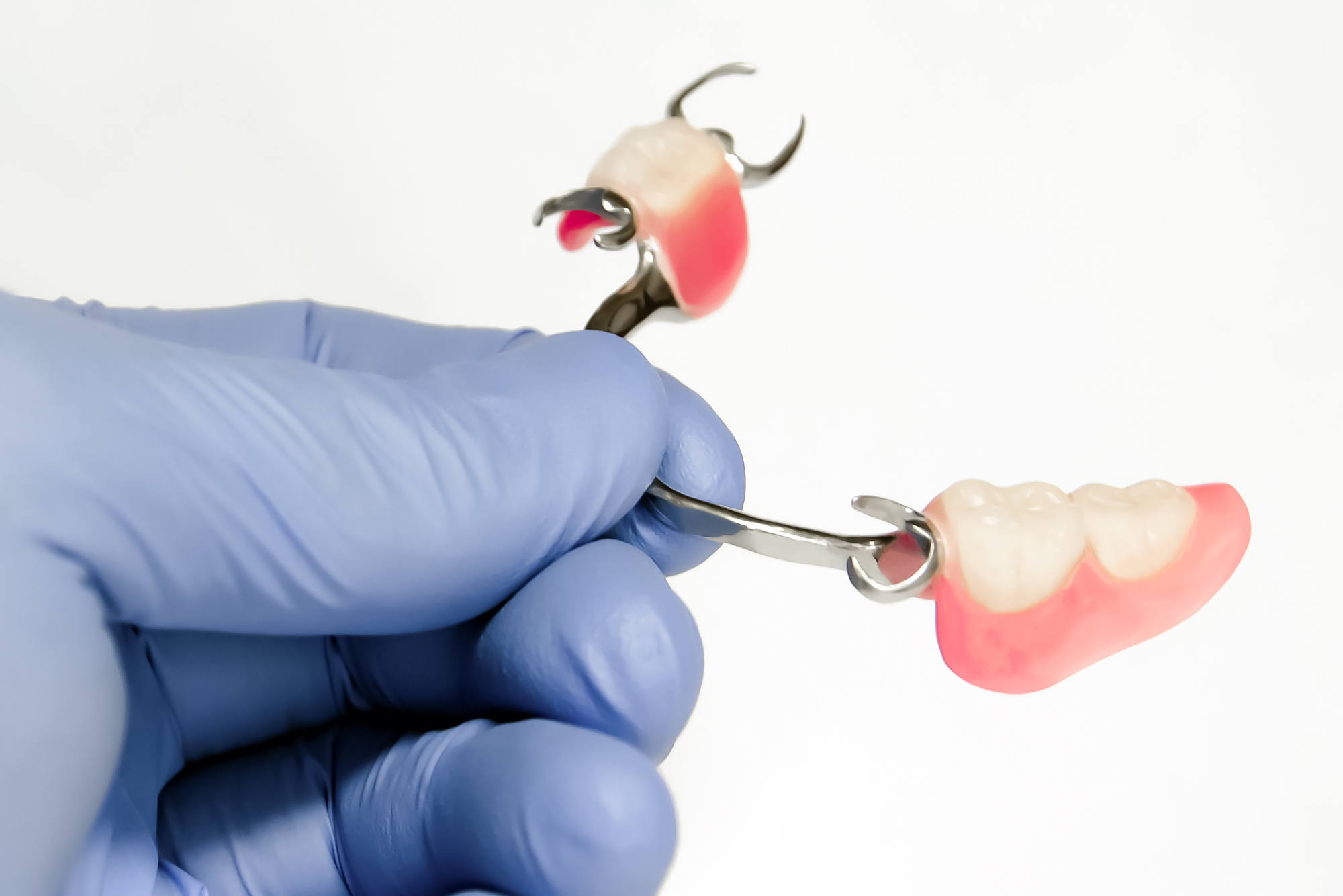 A gloved hand holds partial dentures