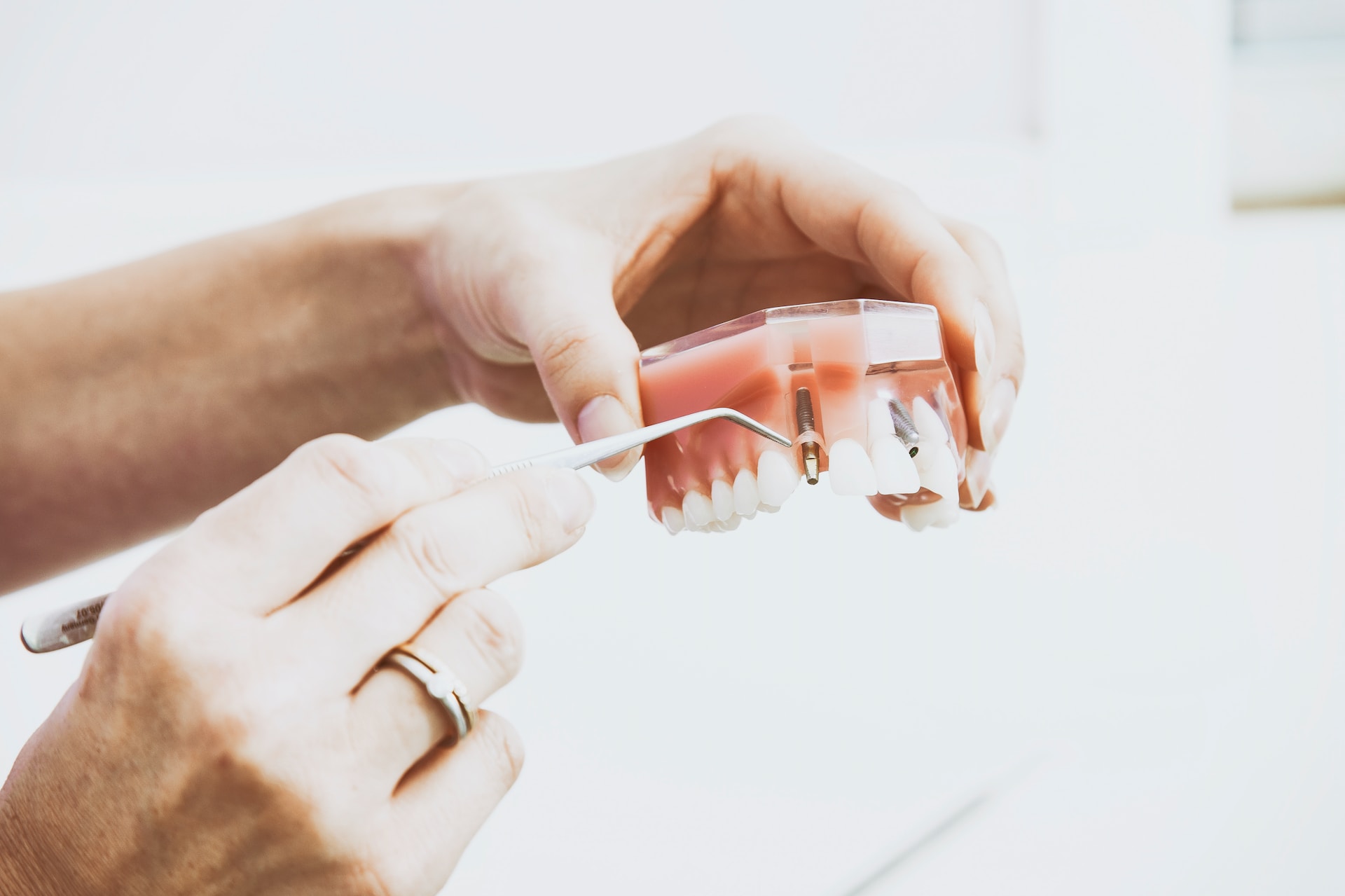 woman's hands holding denture with dental implant