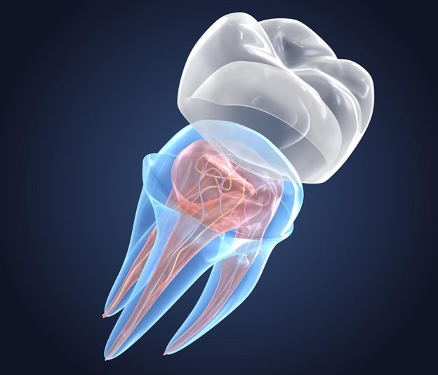 dental crowns illustration