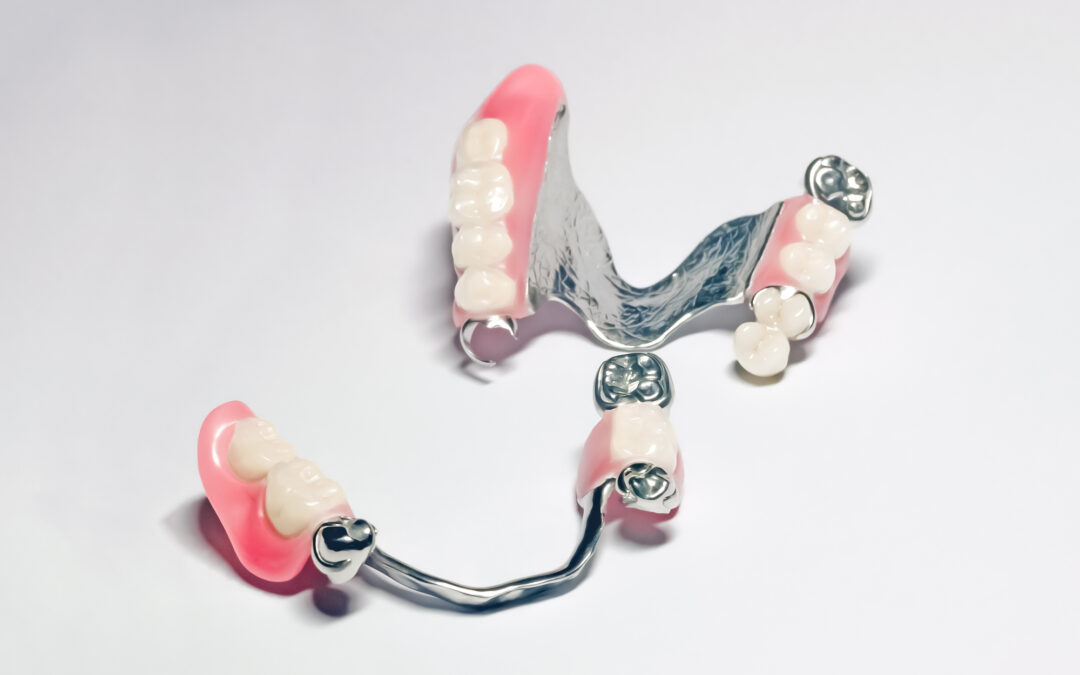 Top 5 Ways Partial Dentures Improve Oral Health
