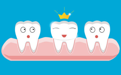 Decoding Dental Crowns: Types, Safety, Cost, and Longevity