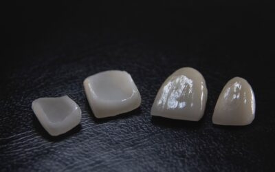 Composite Resin vs. Porcelain Dental Veneers: Choosing the Right Smile Enhancement