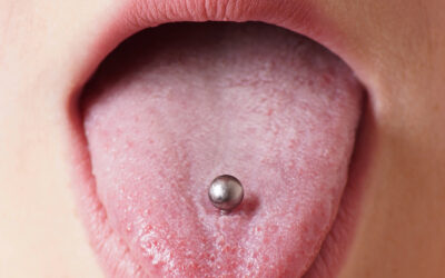 Ask Our Las Vegas Dentists: Are tongue piercings safe?