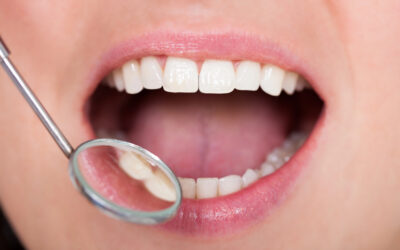 What Really Happens at a Checkup & Cleaning: Dentist in Vegas Breaks It Down