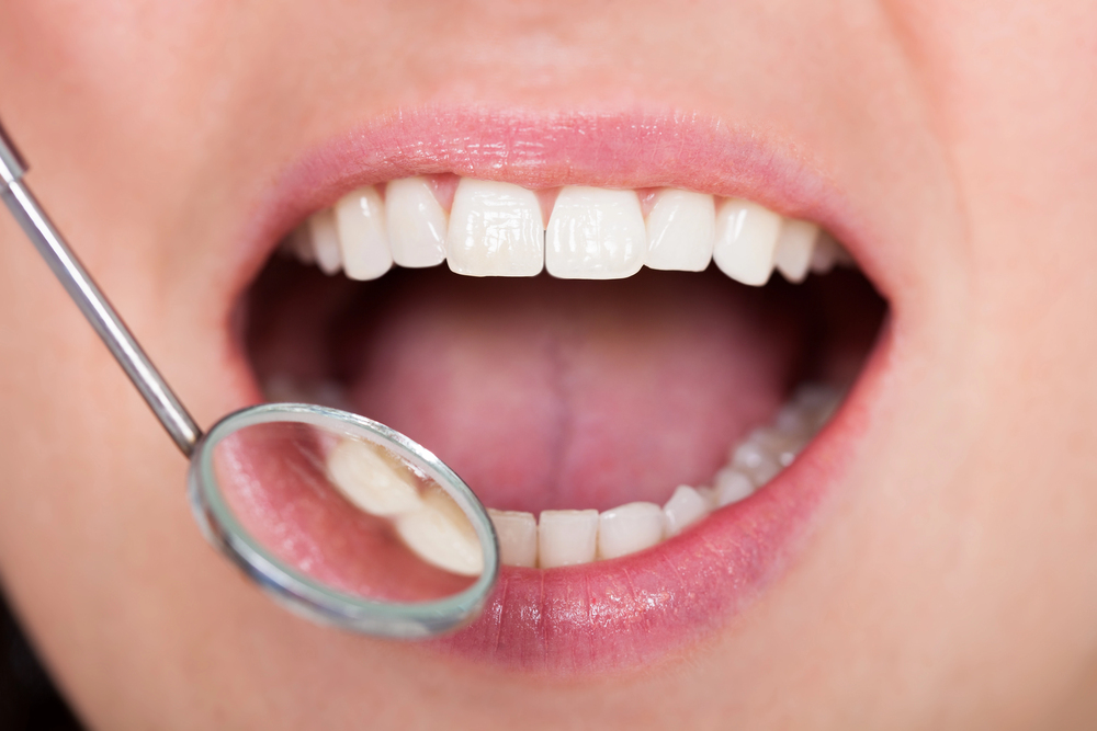 close up of dentist looking into woman's mouth with a dental mirror