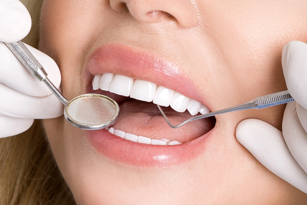 close up of woman's teeth being examined by dentist with dental mirror and pick