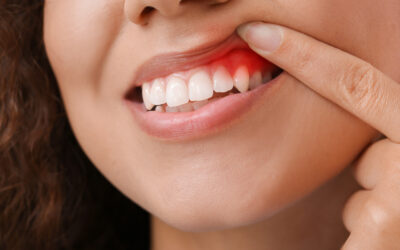 What Are the Early Signs of Gum Disease, and How Can I Prevent It?