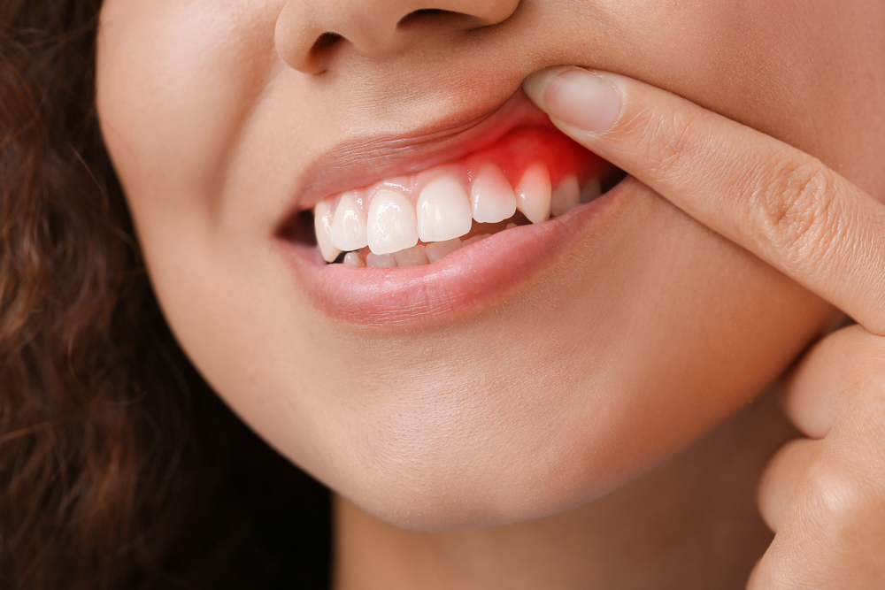 Here’s What Your Dentist in Vegas Wants You to Know About Gum Disease and Diabetes