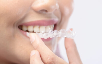 Invisalign® Comfort Tips: How to Handle Soreness and Adjustments