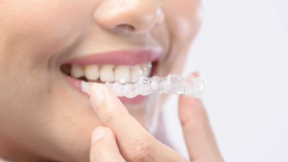 Invisalign® Comfort Tips: How to Handle Soreness and Adjustments