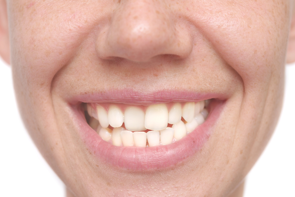 Do I Need to See the Dentist? 7 Signs You Shouldn’t Ignore