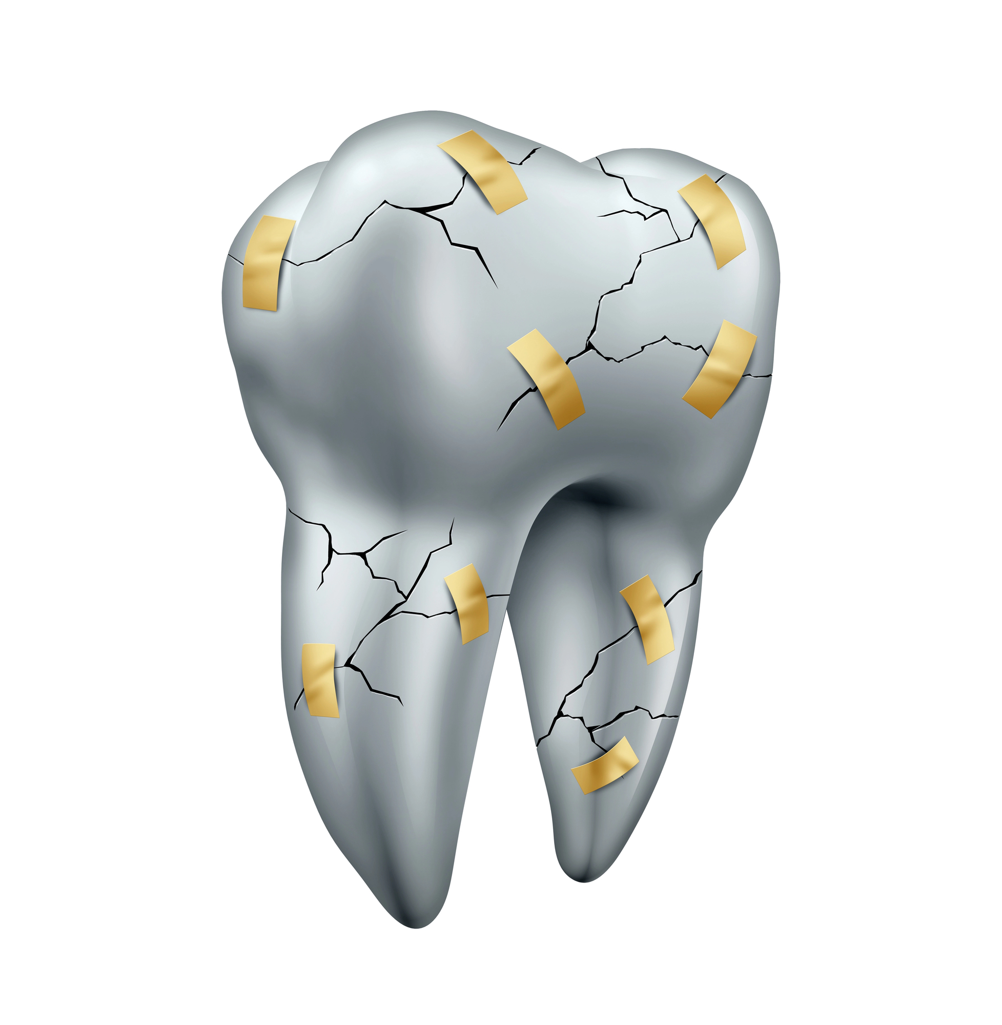 3D illustration of a broken tooth with many cracks in it being held together by many bandages
